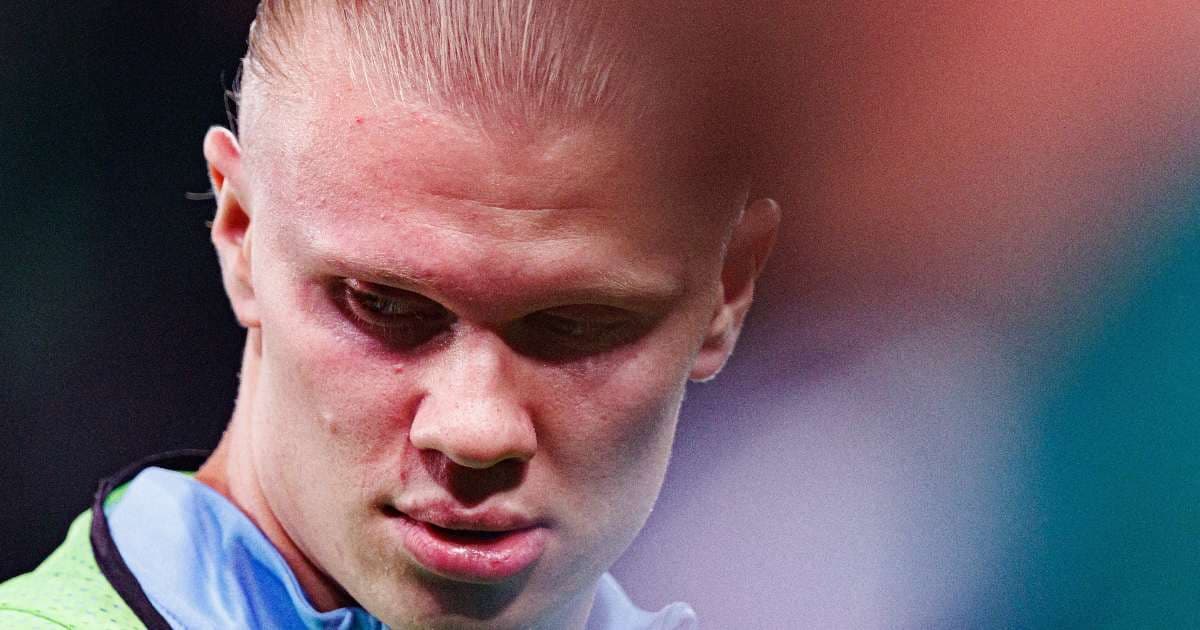 Pronostico Manchester City - Brighton: analisi e probabili formazioni 07/01/2026 Premier League