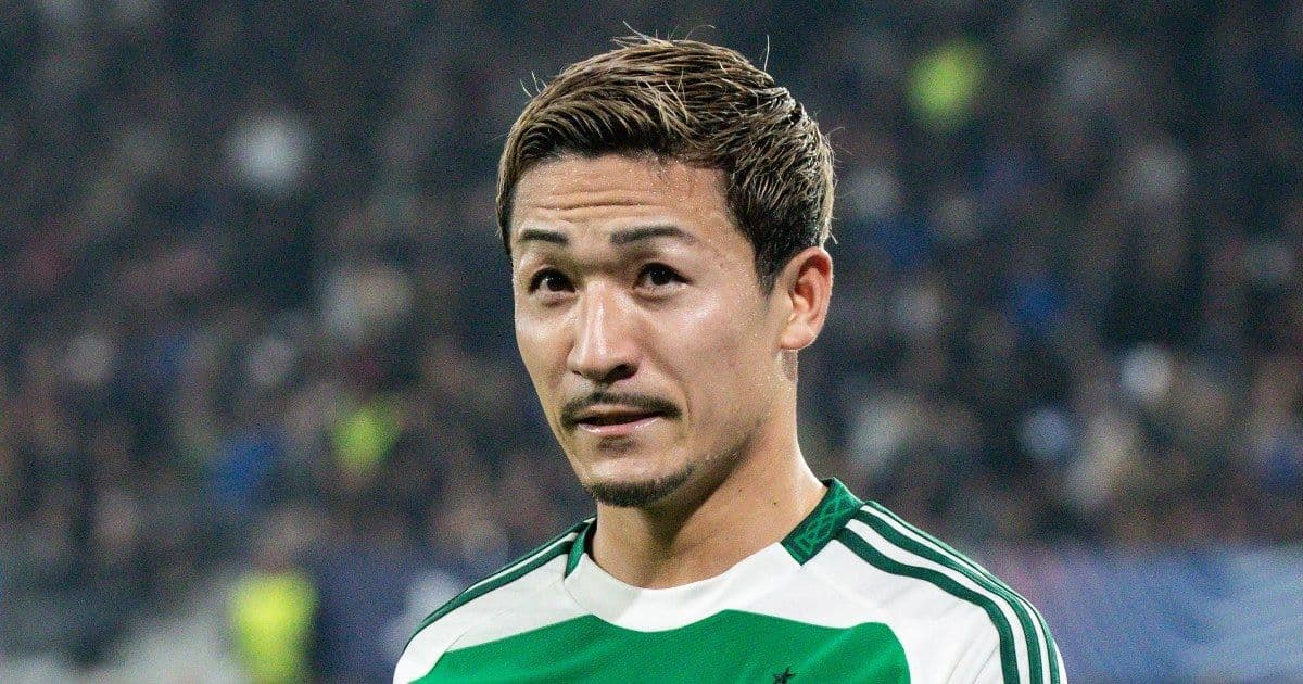 Pronostico Celtic-Stoccarda: analisi e probabili formazioni 19/02/2026 Europa League